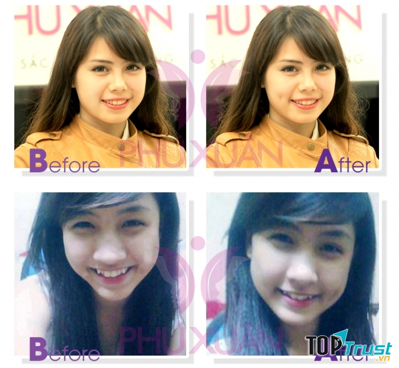 Khách hàng tạo má lúm tại TMV Phú Xuân