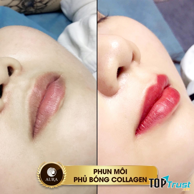 Thẩm Mỹ Viện Quốc Tế Aura