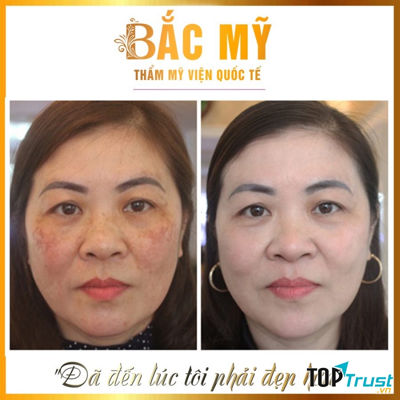 Thẩm Mỹ Viện Quốc Tế Bắc Mỹ