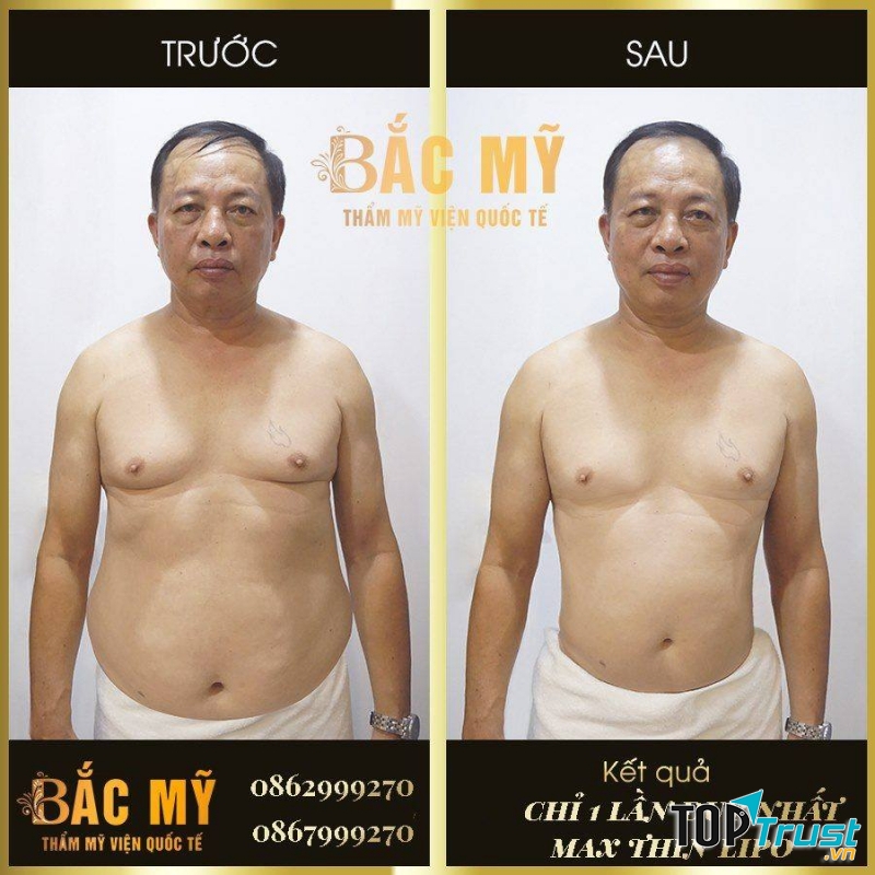 Thẩm Mỹ Viện Quốc Tế Bắc Mỹ
