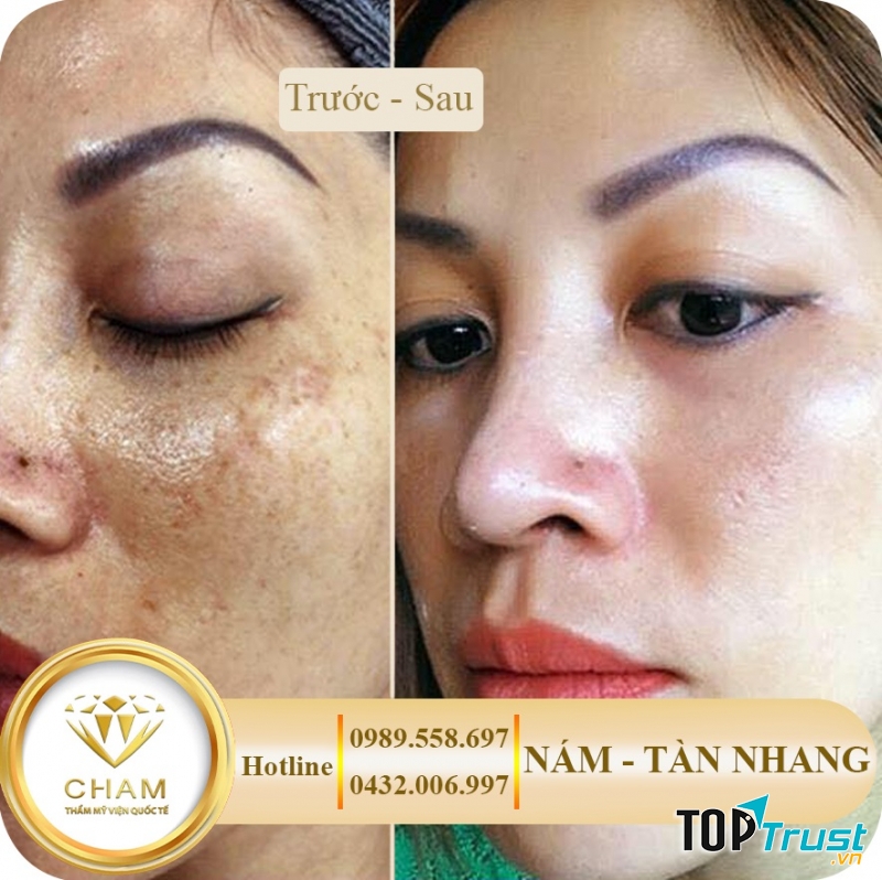 Thẩm Mỹ Viện Quốc Tế Cham