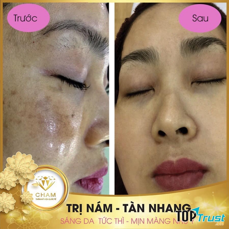 Thẩm Mỹ Viện Quốc Tế Cham