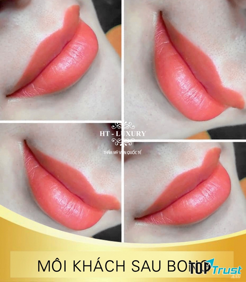 THẨM MỸ VIỆN QUỐC TẾ HT – LUXURY