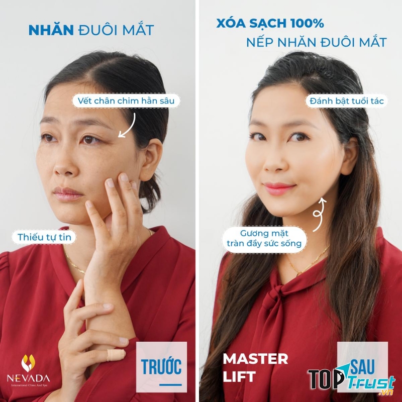 Thẩm Mỹ Viện Quốc Tế Nevada