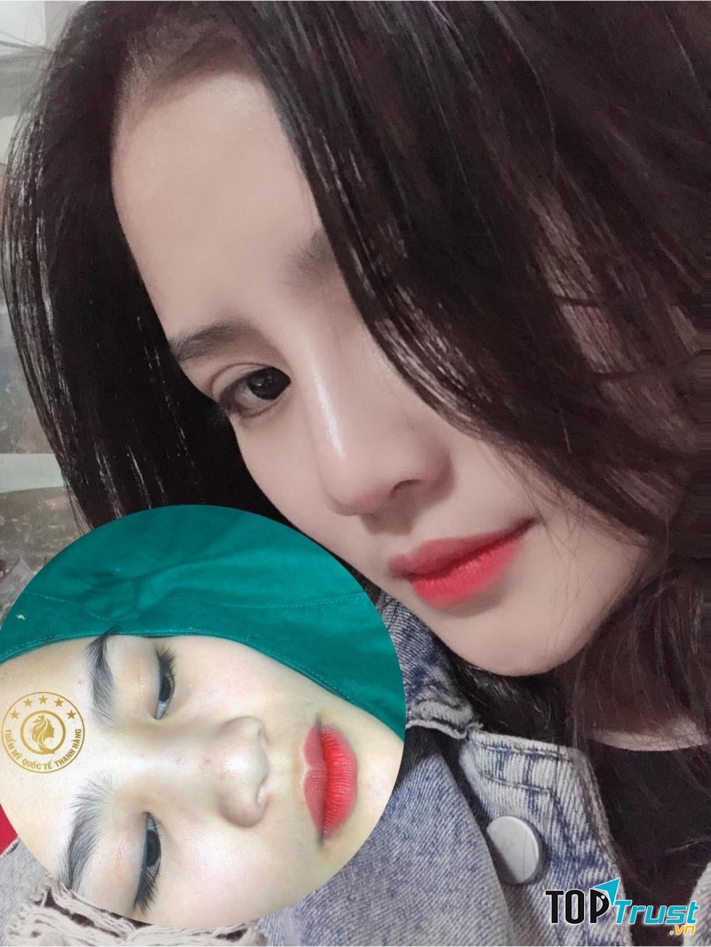 Thẩm mỹ viện Thanh Hằng