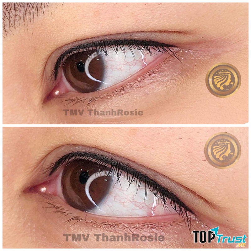 Thẩm Mỹ Viện Quốc Tế ThanhRosie