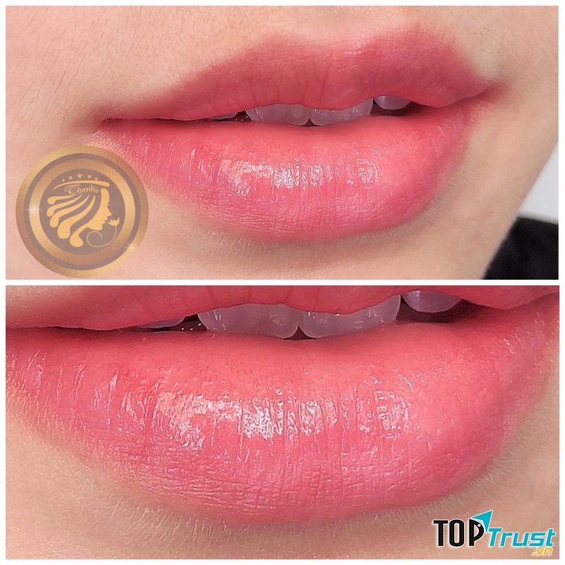 Thẩm Mỹ Viện Quốc Tế ThanhRosie