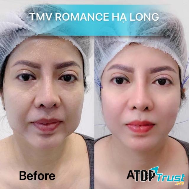 Thẩm Mỹ Viện Romance