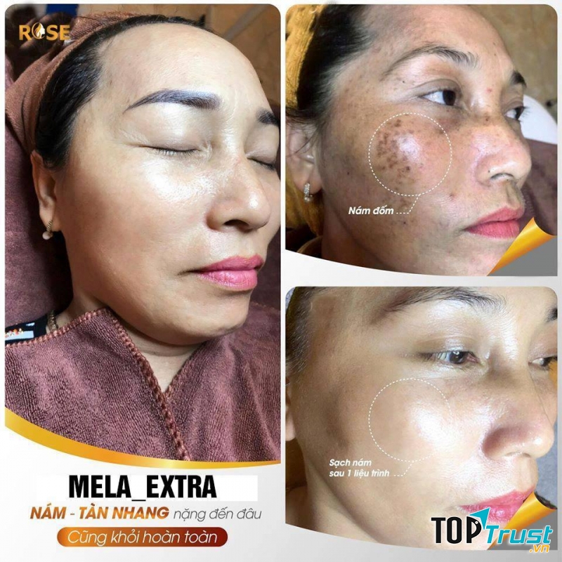 Thẩm Mỹ Viện Rose