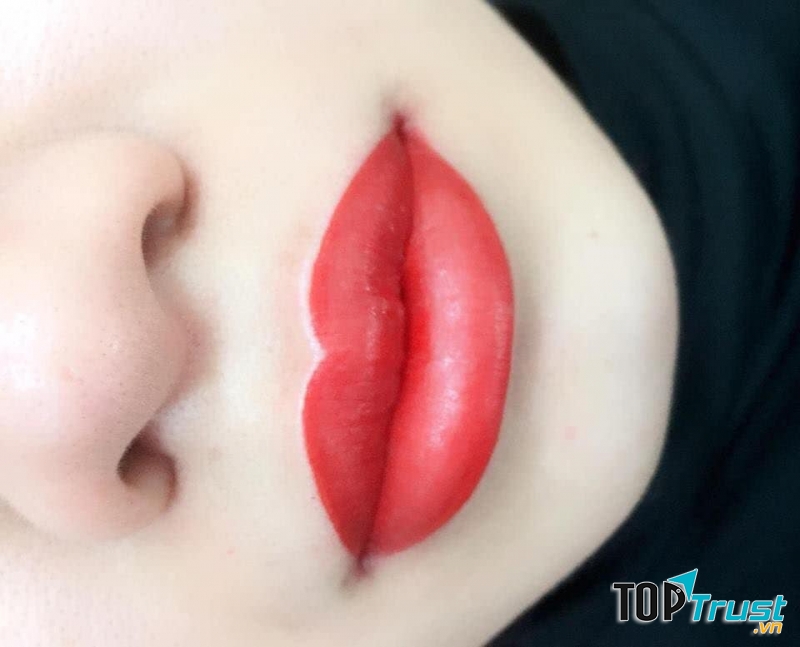 Phun môi tại Thẩm mỹ viện Sài Gòn Luxury Spa