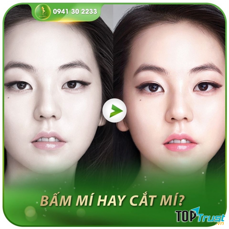 Đến với Thẩm mỹ viện Sài Gòn Venus để được tư vấn bạn nhé!