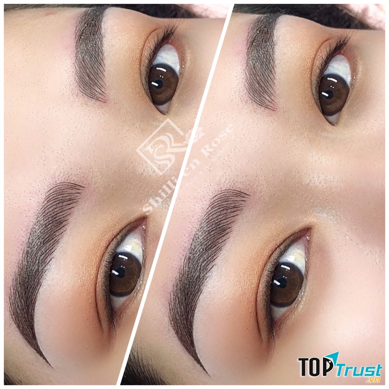 Thẩm Mỹ Viện Shilli en Rose