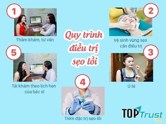 Quy trình điều trị sẹo lồi tại Sky Diamond