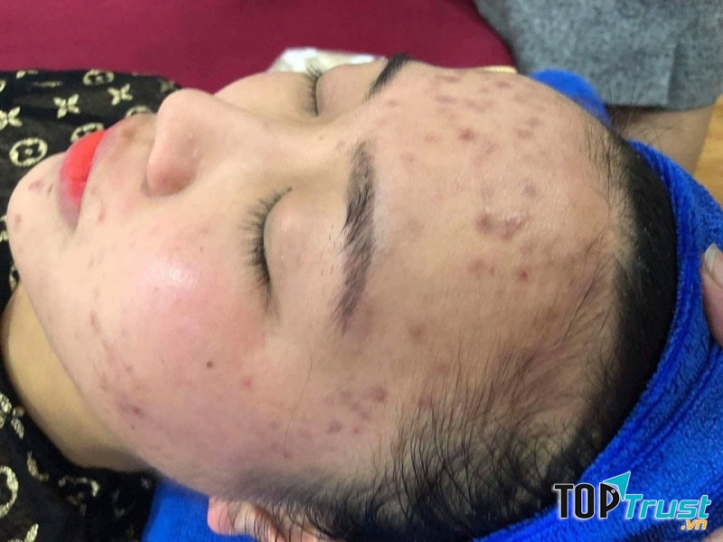 Thẩm mỹ viện Spa Ngọc Anh