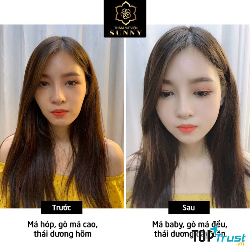 Thẩm Mỹ Viện SUNNY - Beauty & Clinic