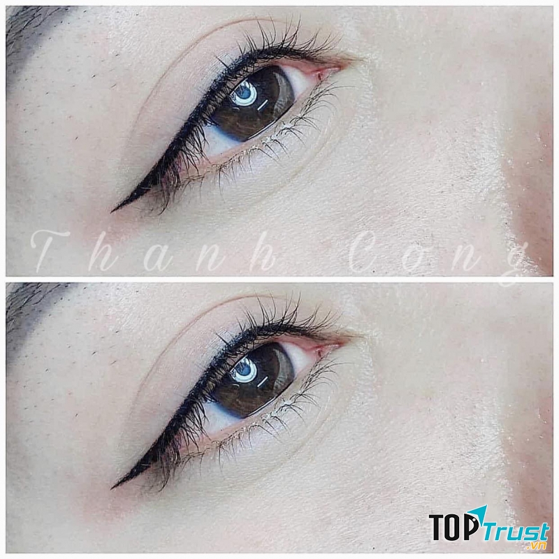 Thẩm Mỹ Viện Thành Công