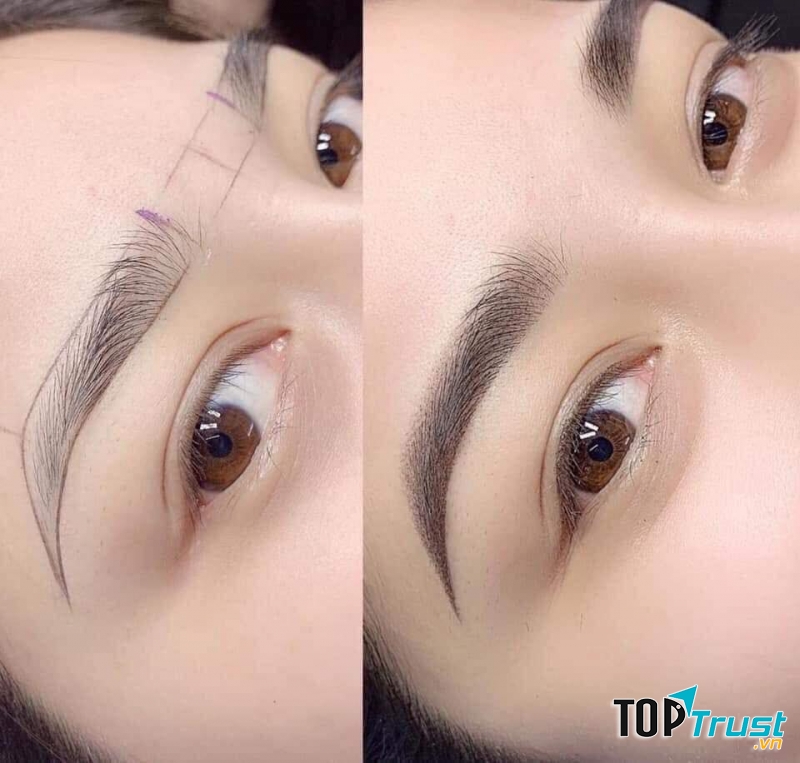 Thẩm Mỹ Viện Thành Công