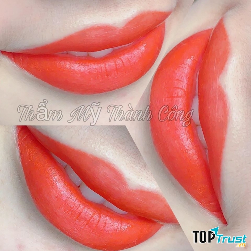 Thẩm Mỹ Viện Thành Công