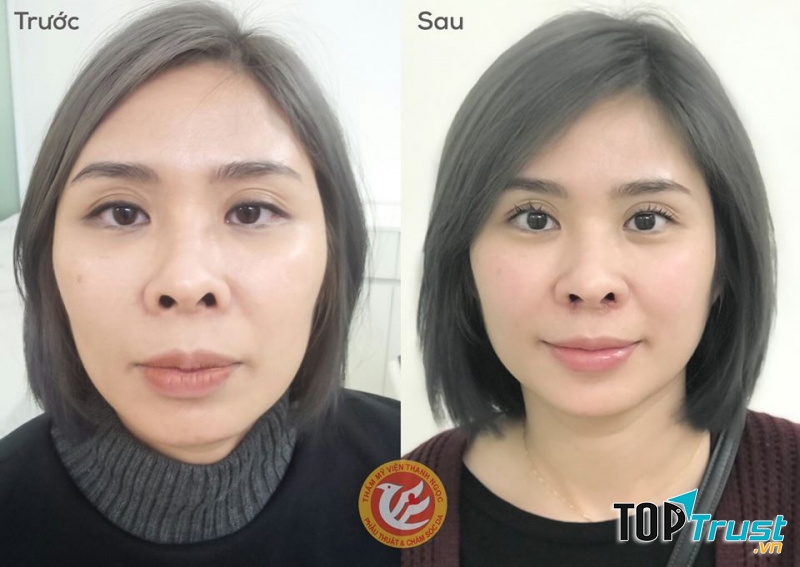 Thẩm Mỹ Viện Thanh Ngọc