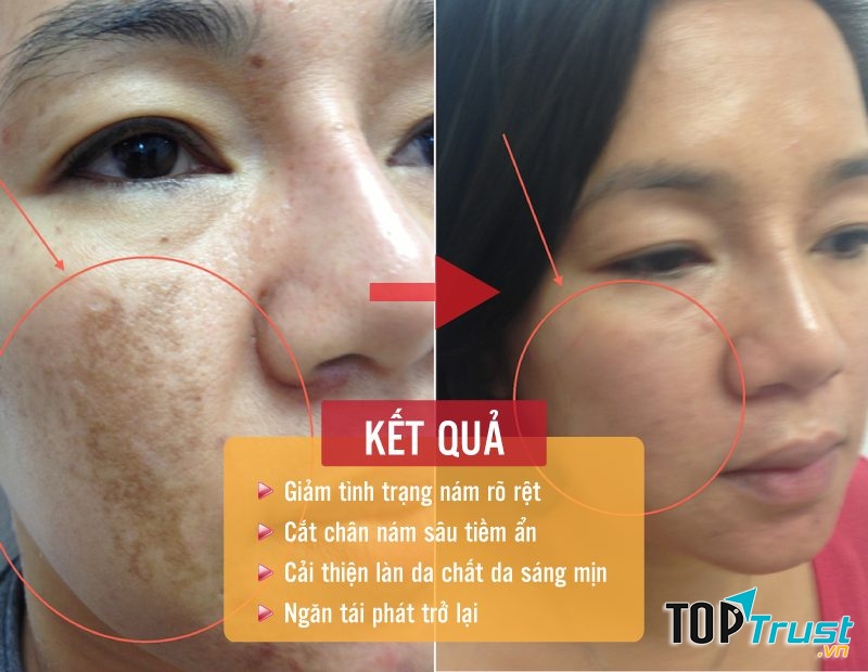 Thẩm mỹ viện Thiên Hà