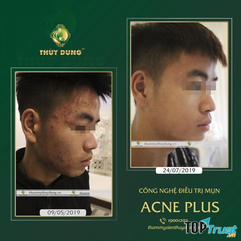 Thẩm Mỹ Viện Thùy Dung