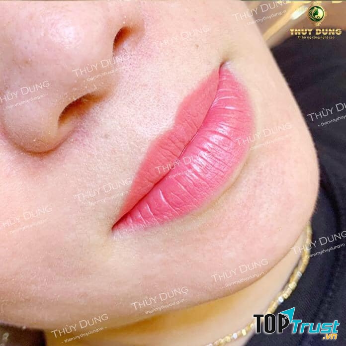 Thẩm Mỹ Viện Thùy Dung