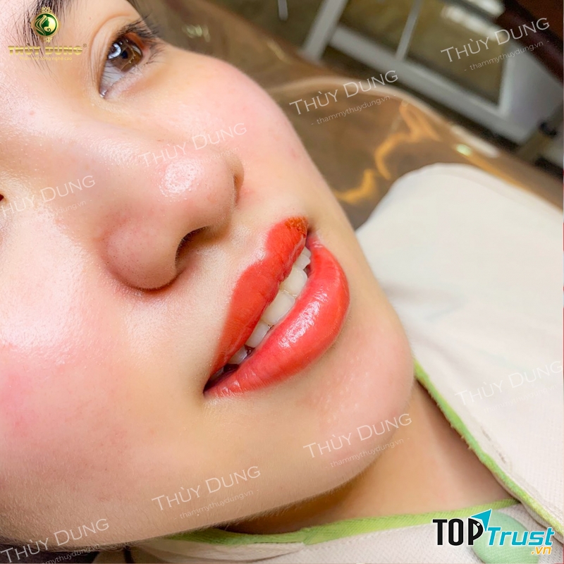 Thẩm Mỹ Viện Thùy Dung