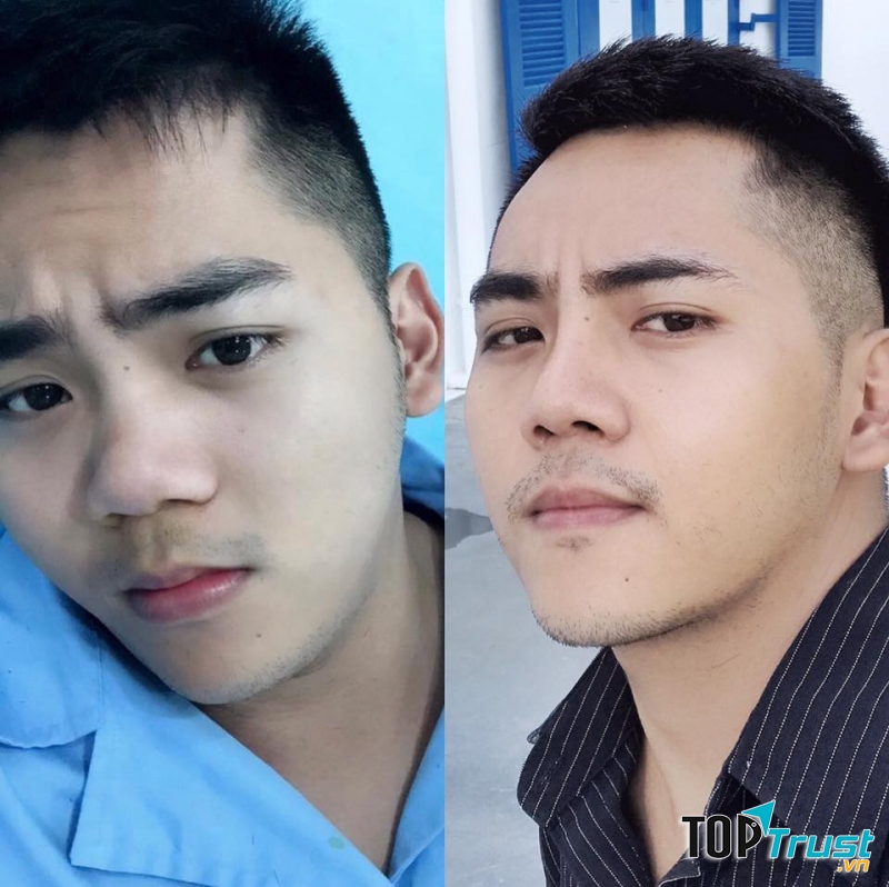 THẨM MỸ VIỆN THÙY DƯƠNG