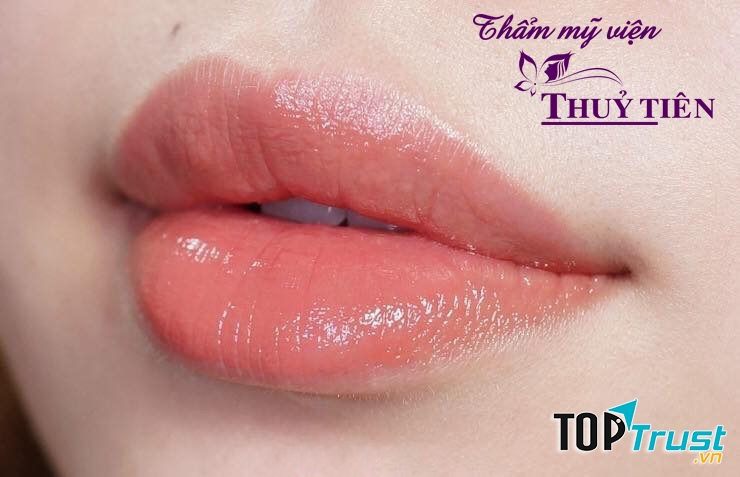 Thẩm Mỹ Viện Thủy Tiên
