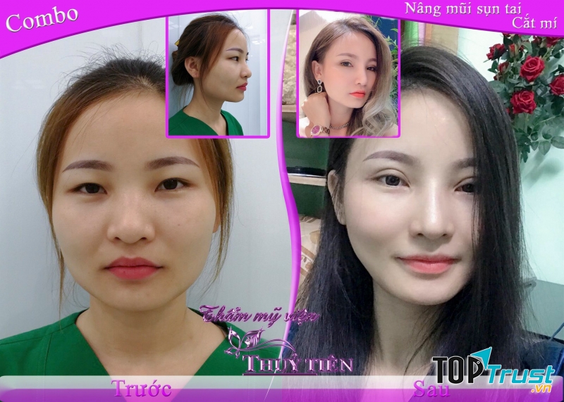 Thẩm Mỹ Viện Thủy Tiên