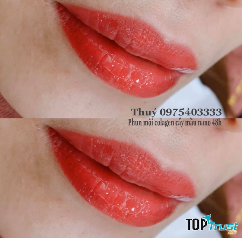 Thẩm mỹ viện Thuy's