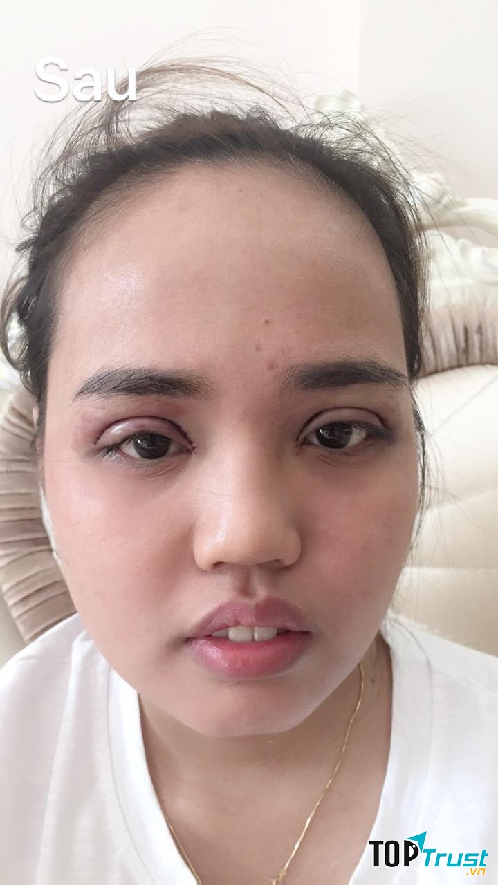 Thẩm Mỹ Viện Trần Trà