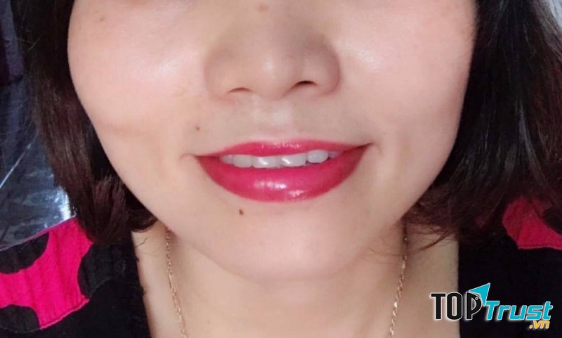 Thẩm mỹ Trang Trang