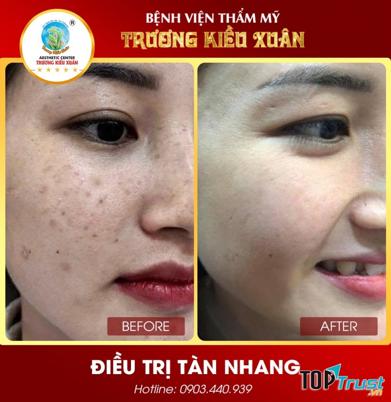 Thẩm mỹ viện Trương Kiều Xuân