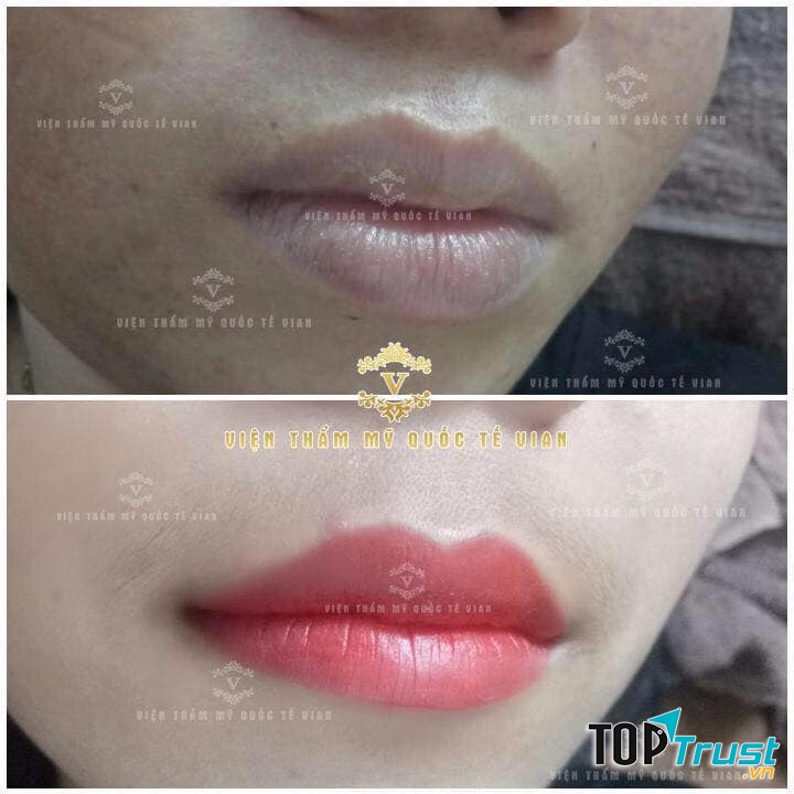 Thẩm Mỹ Viện Vian