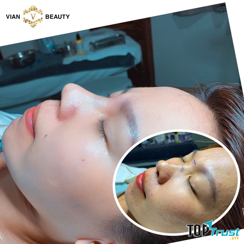 Thẩm Mỹ Viện Vian