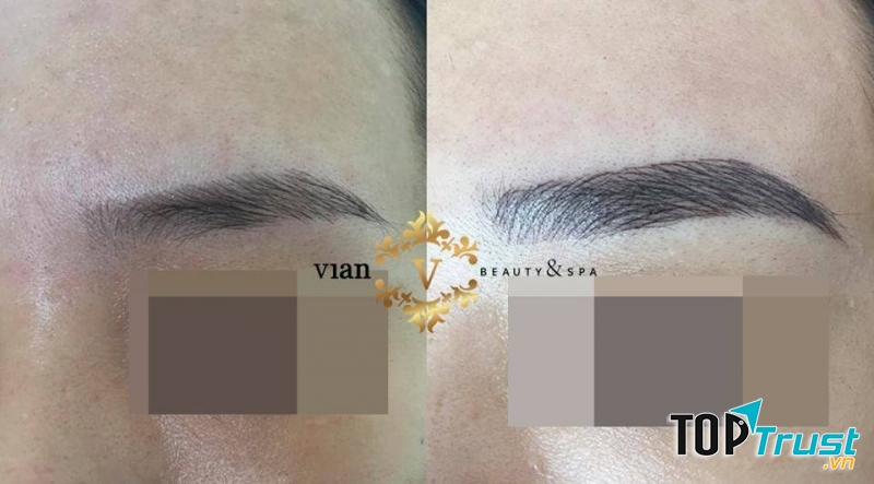 Thẩm Mỹ Viện Vian TP. Phan Rang