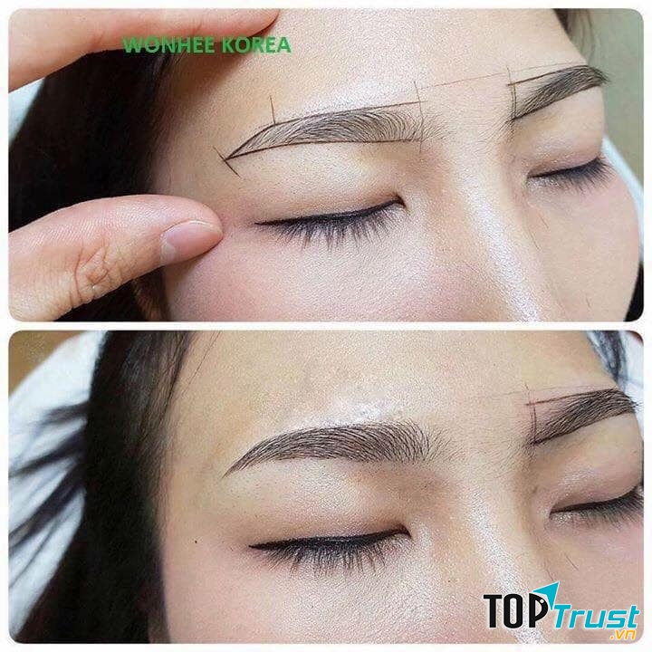 Thẩm Mỹ Viện Wonhee Korea 2