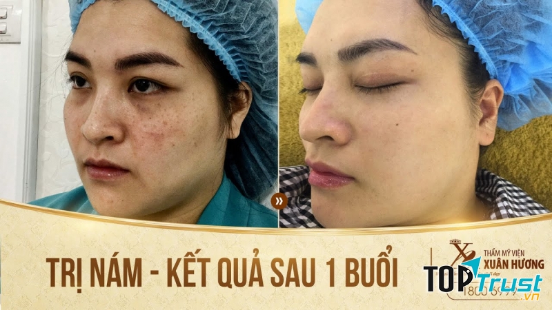 Thẩm mỹ viện Xuân Hương