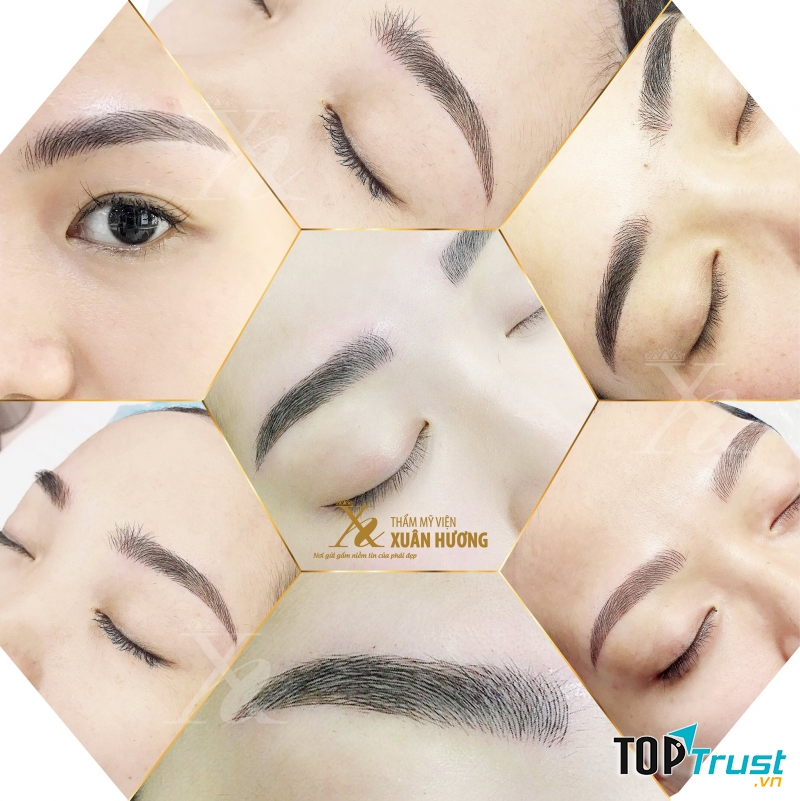 Thẩm mỹ viện Xuân Hương