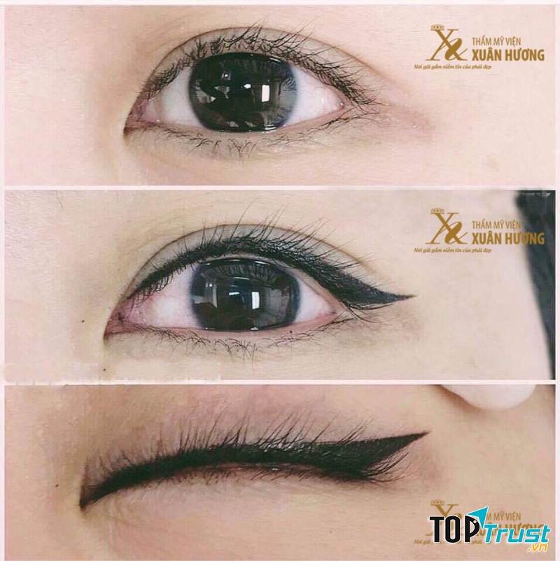 Thẩm mỹ viện Xuân Hương