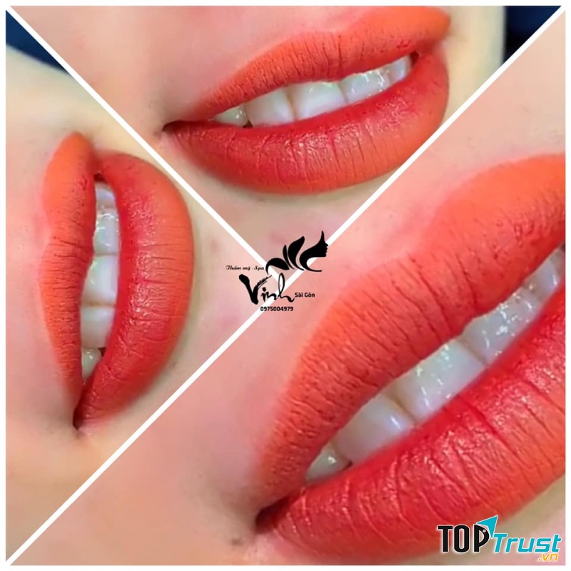 Thẩm mỹ Vinh Sài Gòn