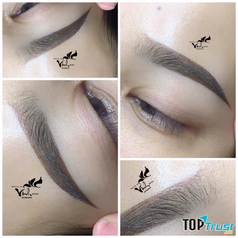 Thẩm mỹ Vinh Sài Gòn