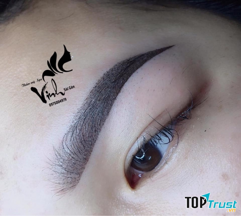 Thẩm Mỹ Vinh Sài Gòn