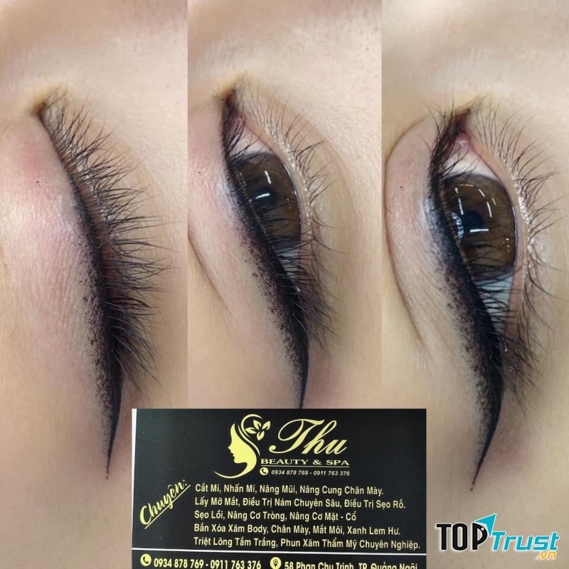 Thẩm Mỹ Xuân Thu Quảng Ngãi