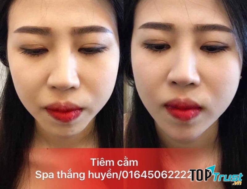 Khác hàng sử dụng dịch vụ tại Thằng Huyền Spa