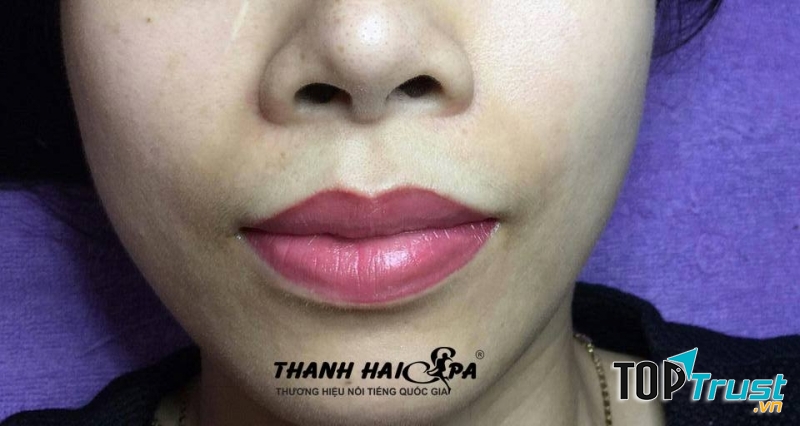 Thanh Hải Spa