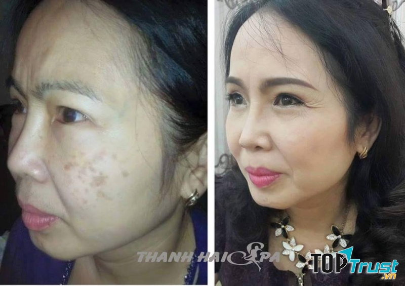 Hình ảnh khách hàng trước và sau điều trị