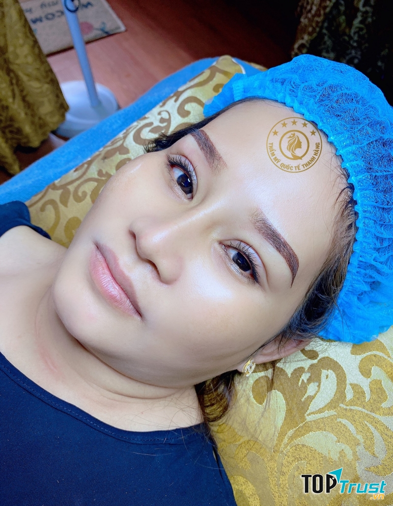 Thanh Hằng – Thẩm mỹ viện quốc tế