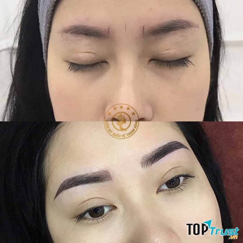 Thanh Hằng – Thẩm mỹ viện quốc tế